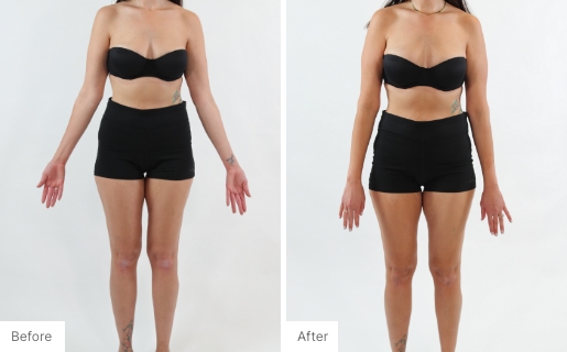 5 - Before and After Real Results of a woman's body from using the 3-in-1 Self Tanning + Sculpting Foam.
